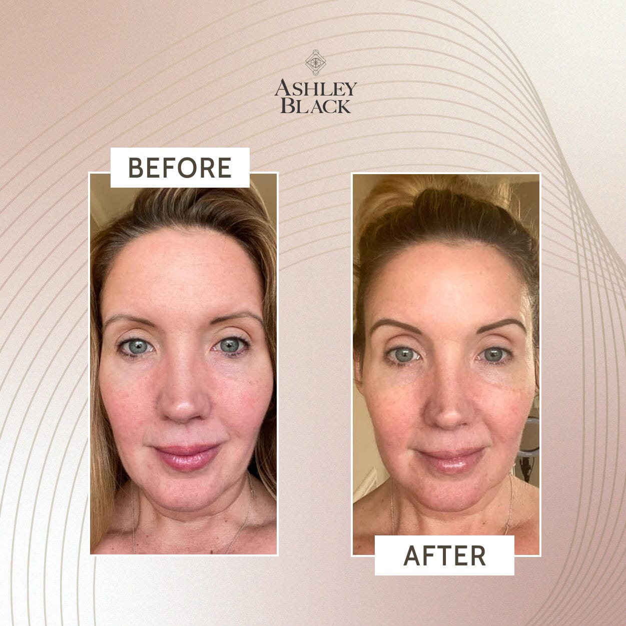 Ashley Black's Kryopack™ Face Wrap