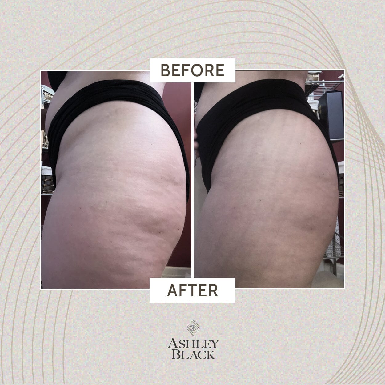 Ashley Black's Kryopack™ Wrap