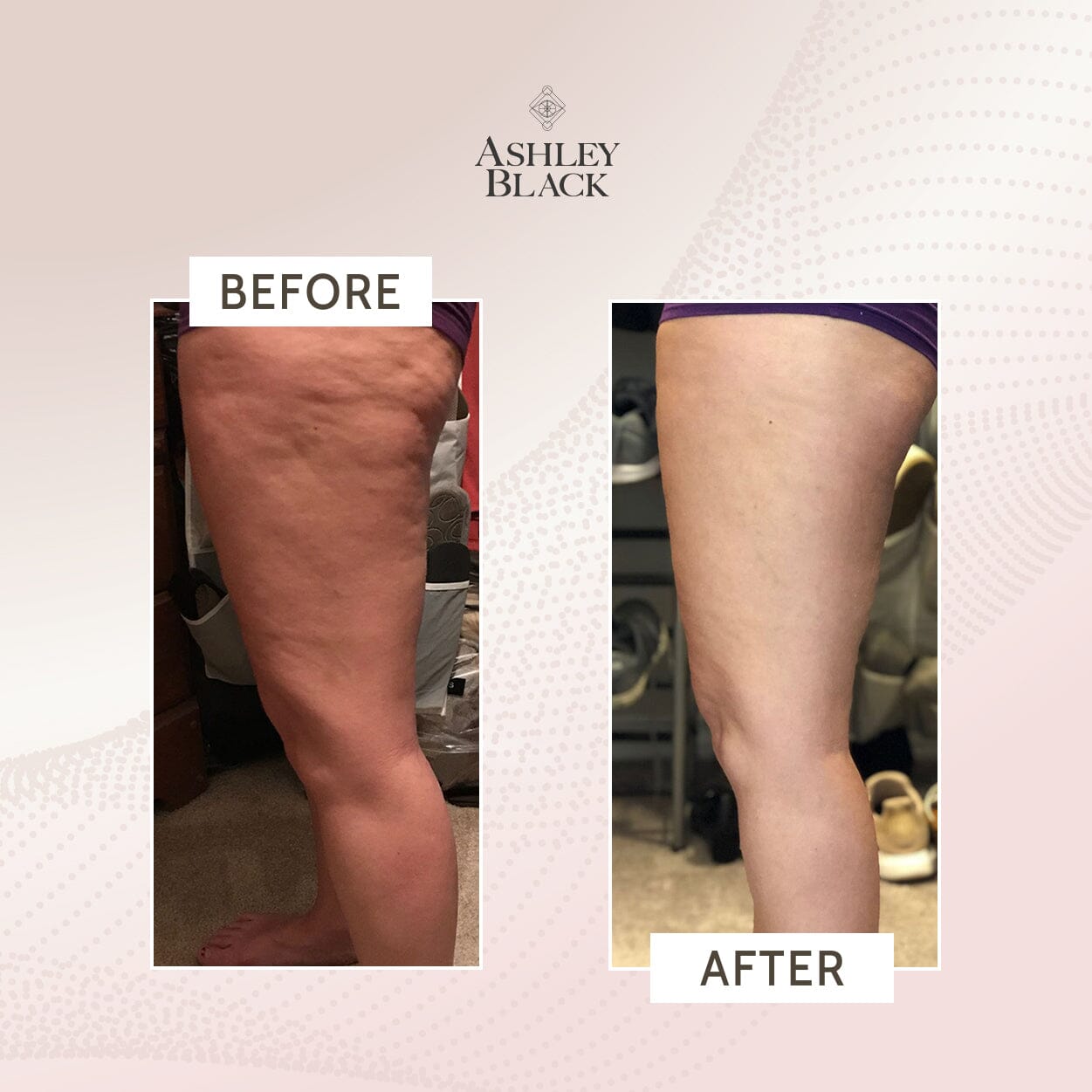 ProBlaster™️️️️️️