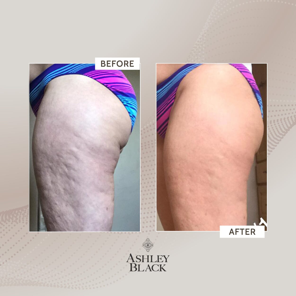 BigDaddy FasciaBlaster Color White 5