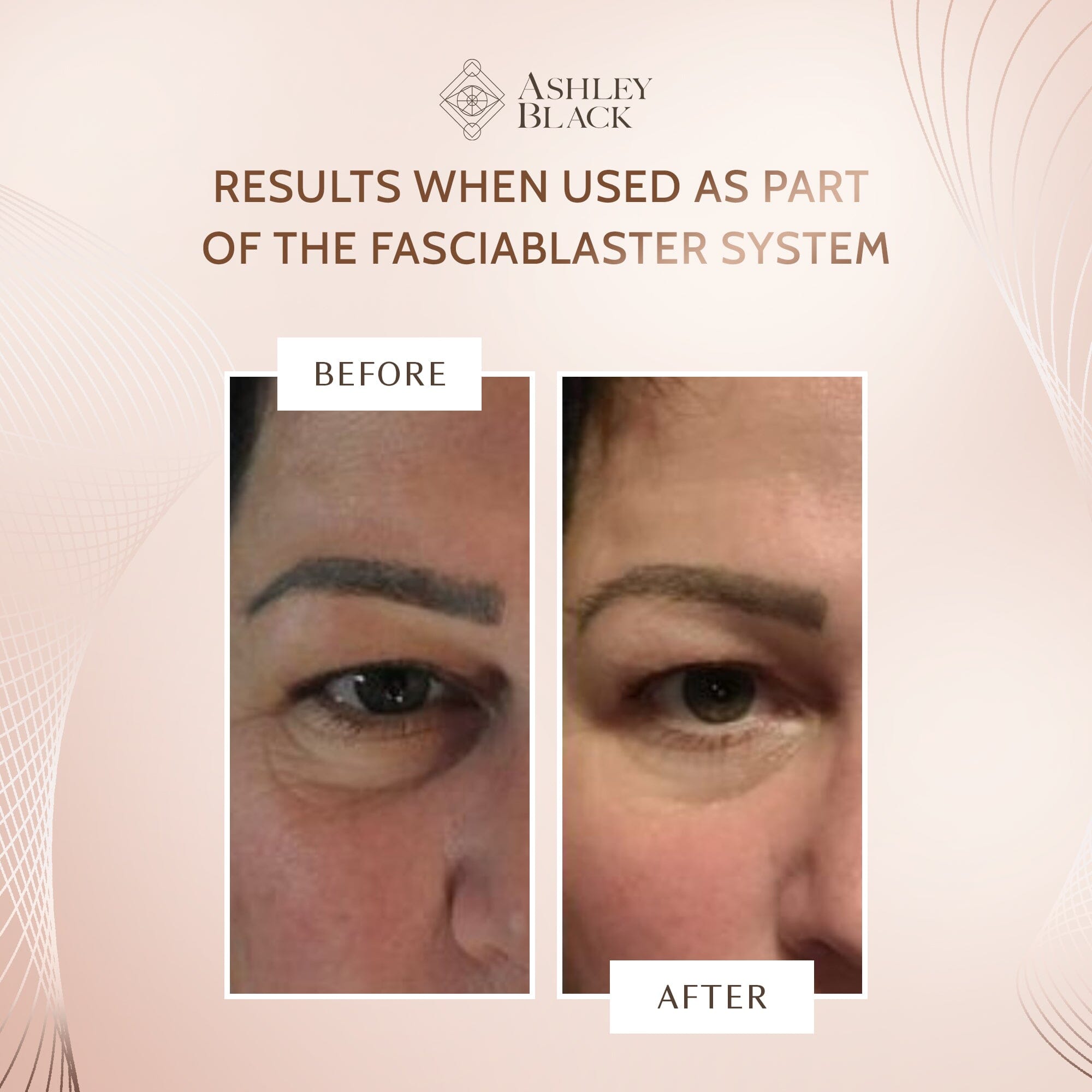 Fine Line Eraser With Handle