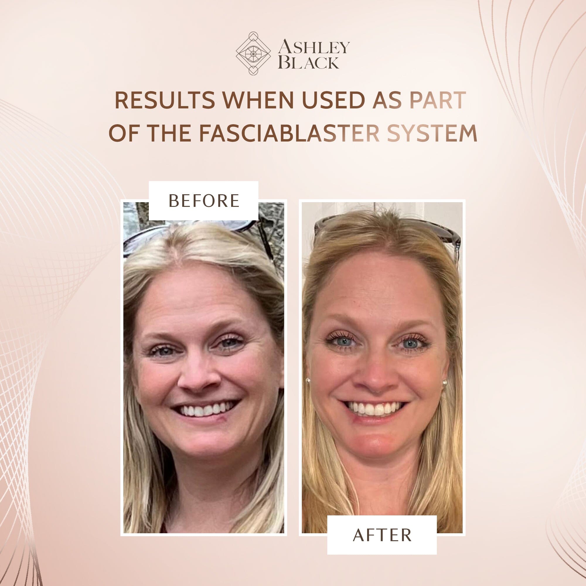 Lymphatic Gua Sha Flusher With Handle