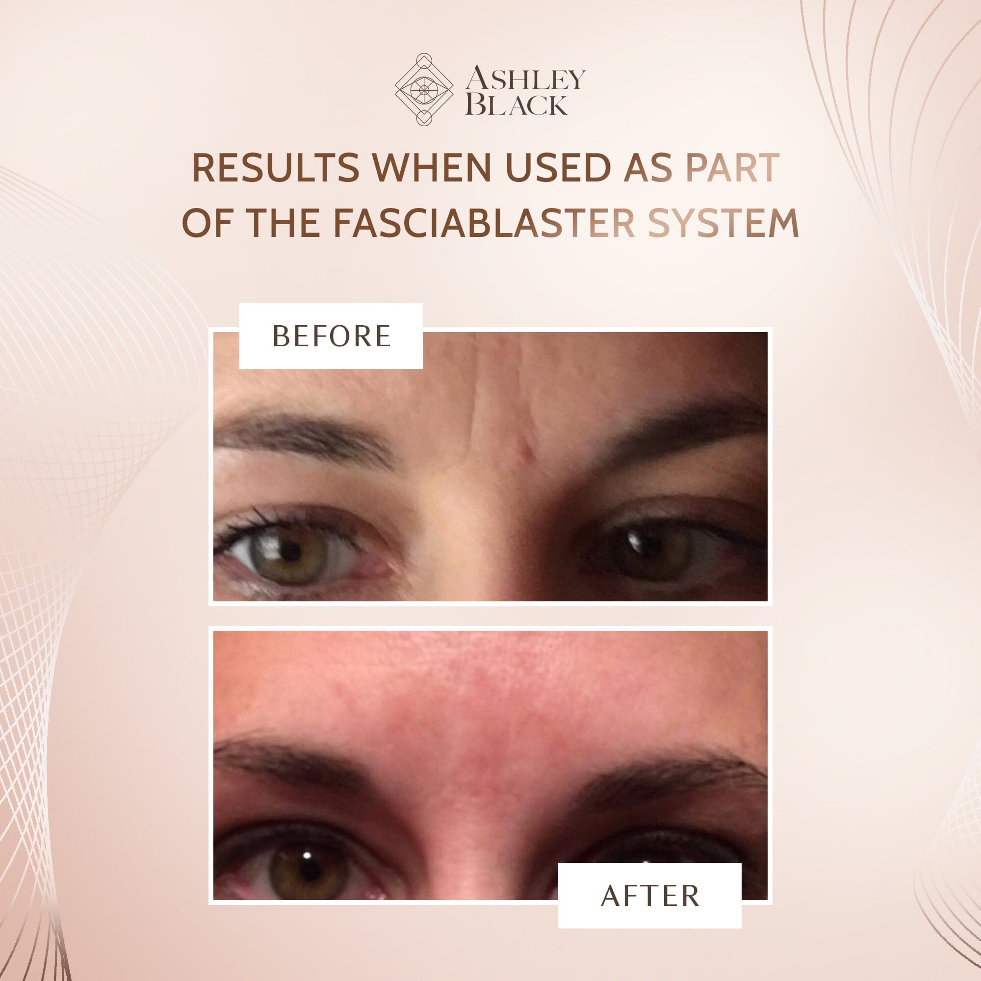 Mini Nugget Trigger Point with handle