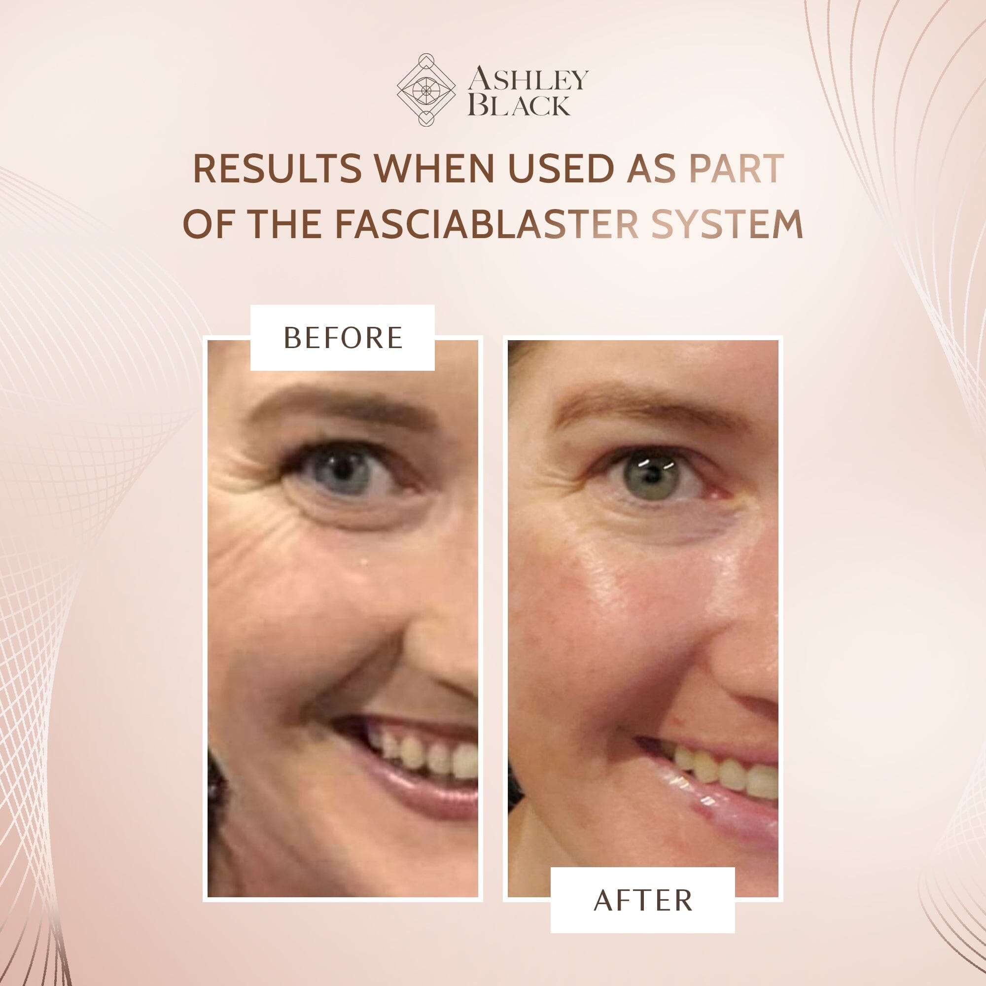 Skin invigorating tool with Handle