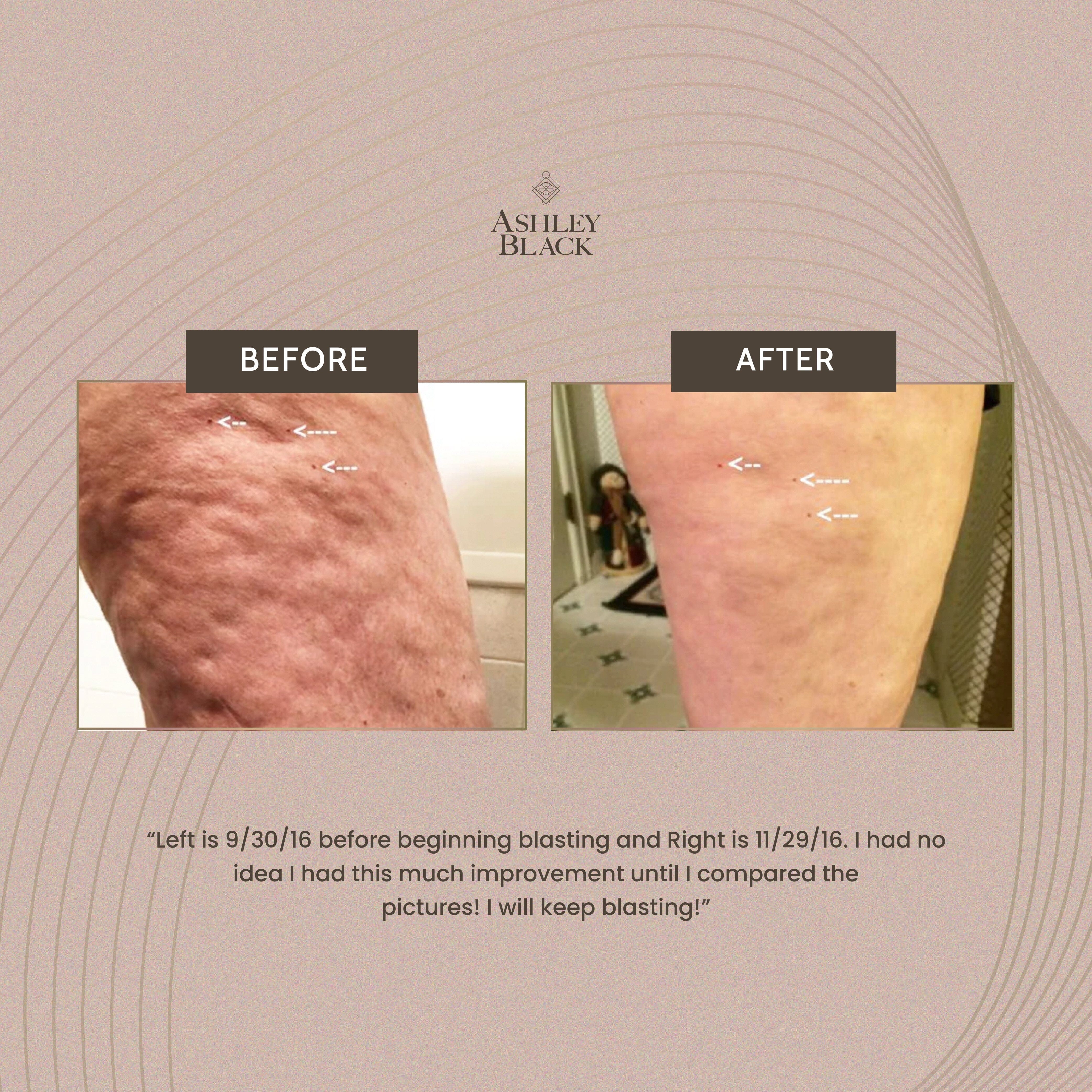 MasterBlaster™ Color White 5