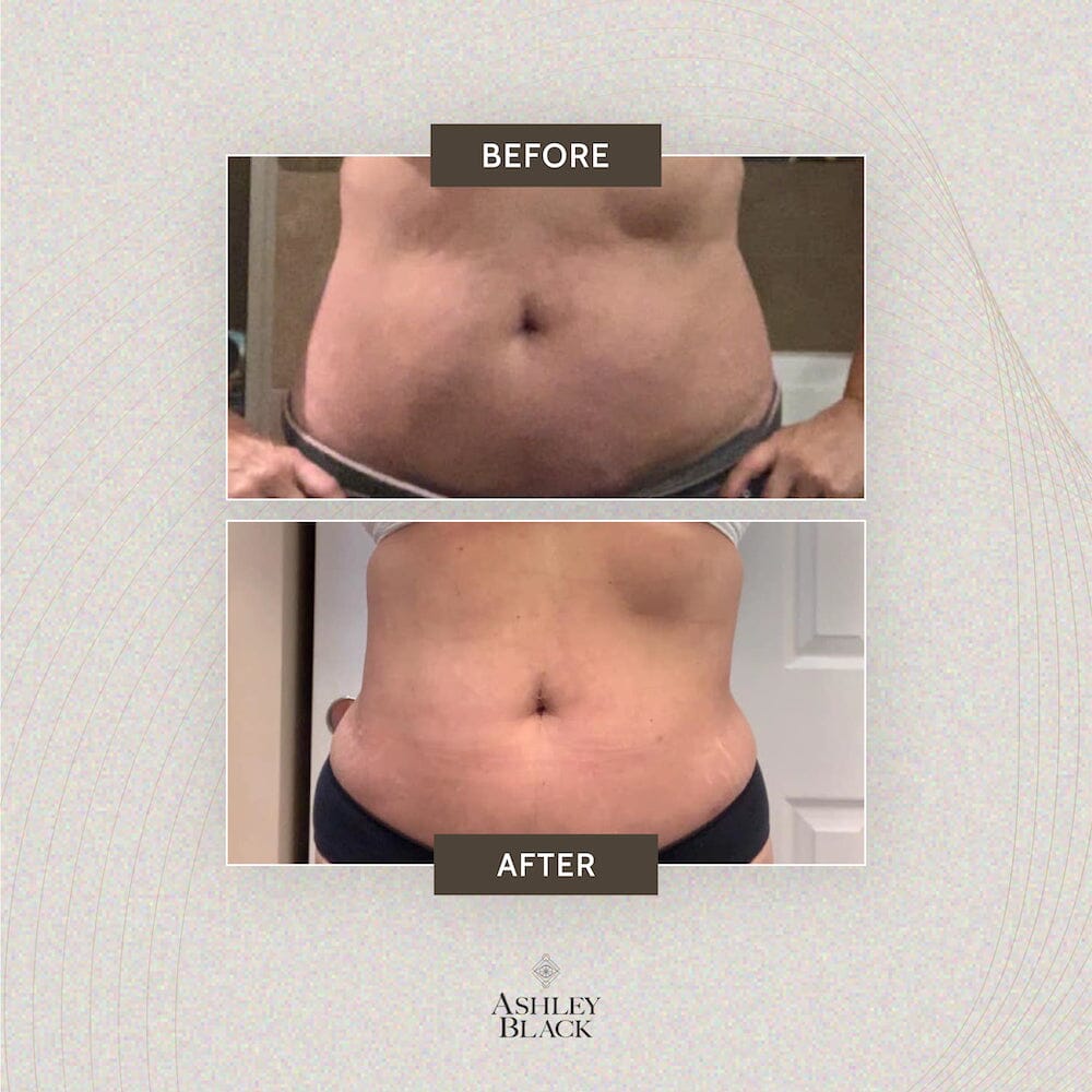 Ashley Black's Kryomat™ Small