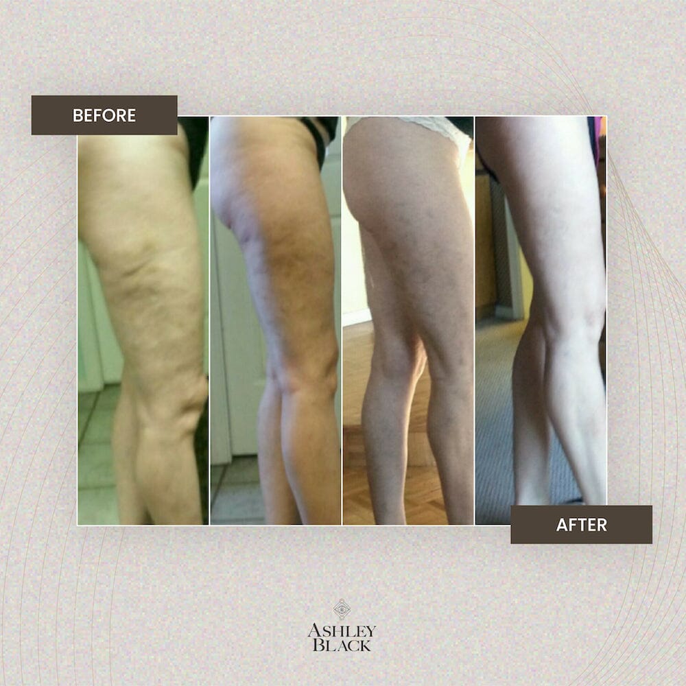 Mini 2™ Color White 5