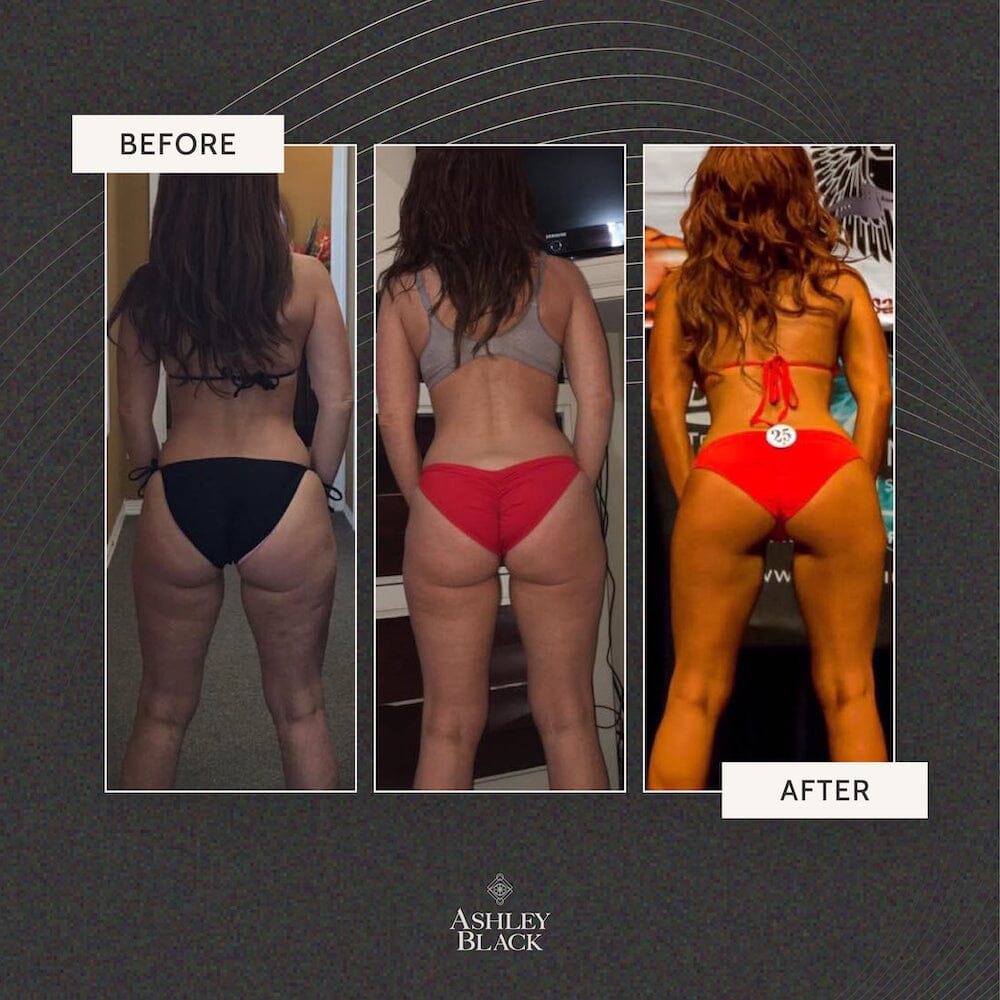 FasciaBlaster® Color Black 5