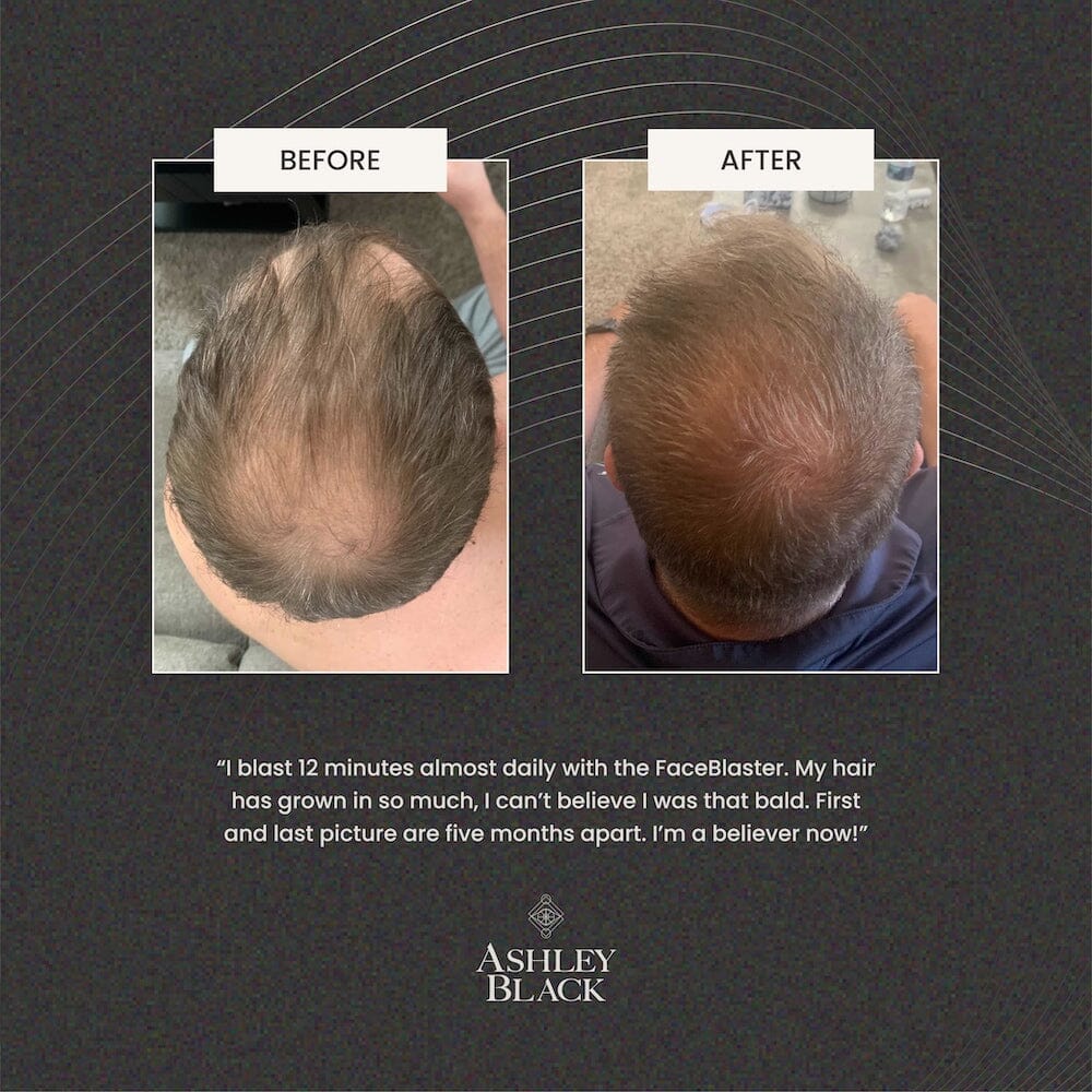 FaceBlaster™ Color Black 5