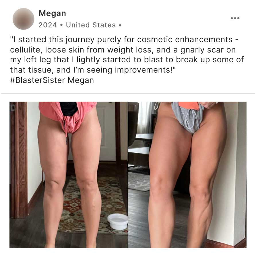 Gorgeous Legs Challenge Part 1