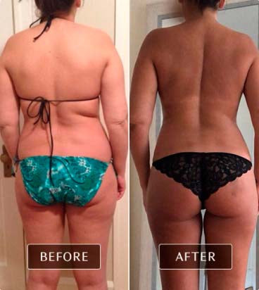 Before and after images of a real user's back and buttocks, highlighting smoother skin and improved muscle tone from FasciaBlaster use.