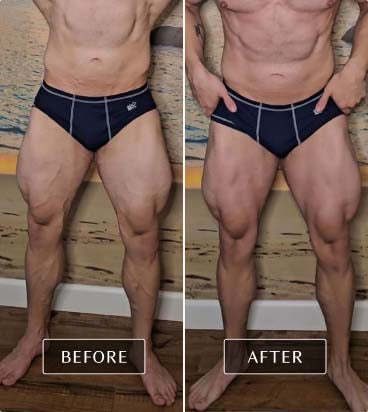 Before and after images of a real user showing enhanced muscle definition and fascia health in the legs through FasciaBlaster use.