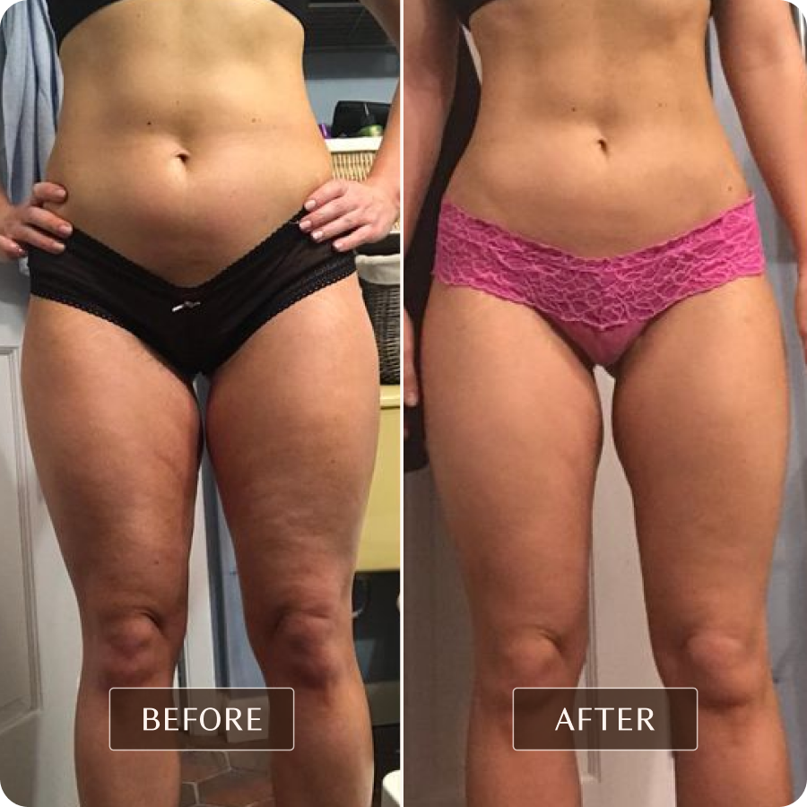 Ashley Black Guru - Before and After Images