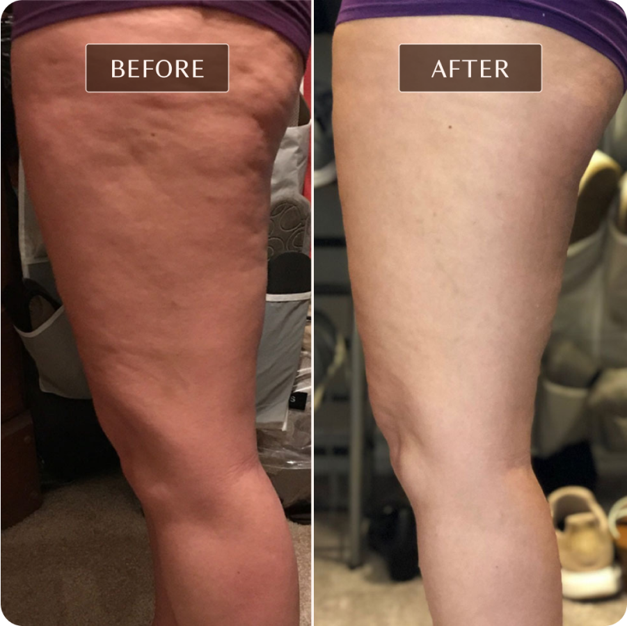 Ashley Black Guru - Before and After Images