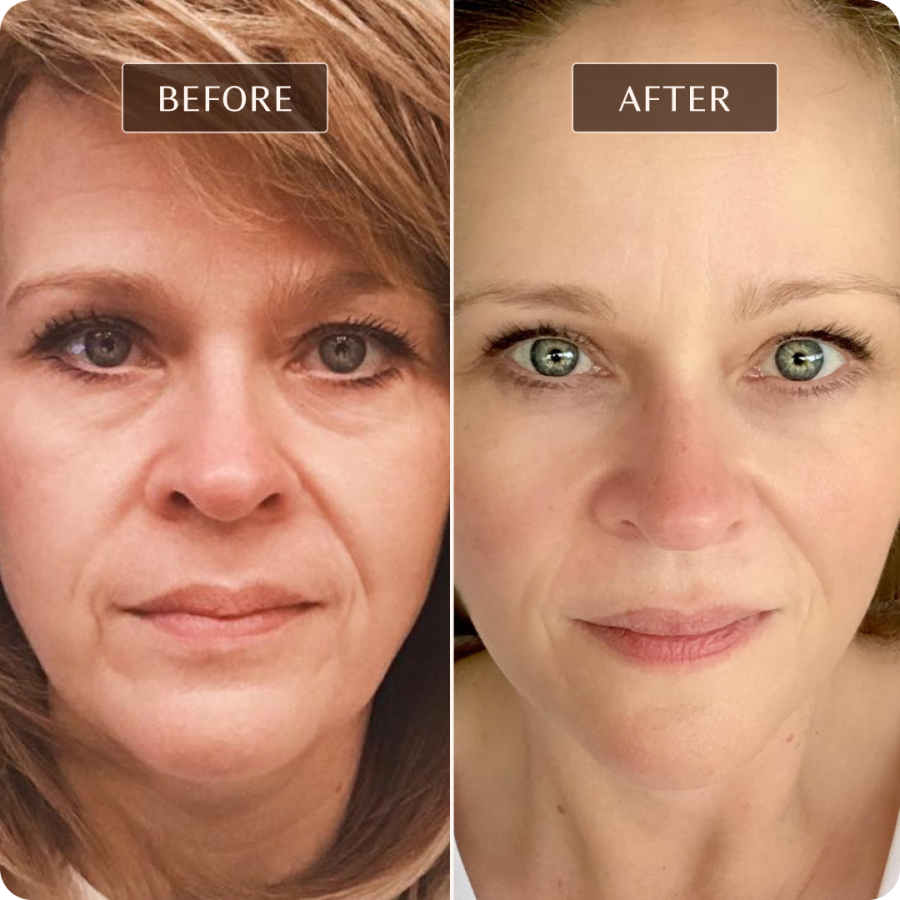 Ashley Black - Before and After Images