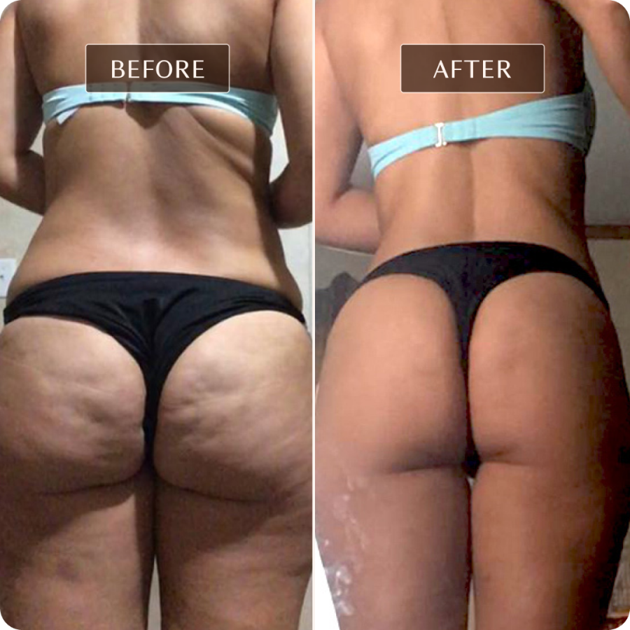 Ashley Black - Before and After Images