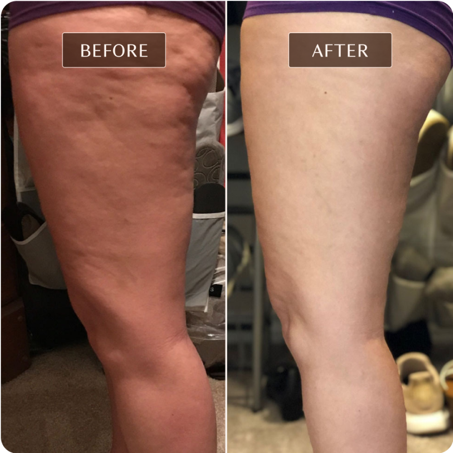 Ashley Black - Before and After Images