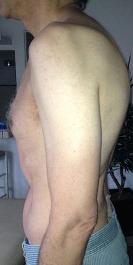 Before image