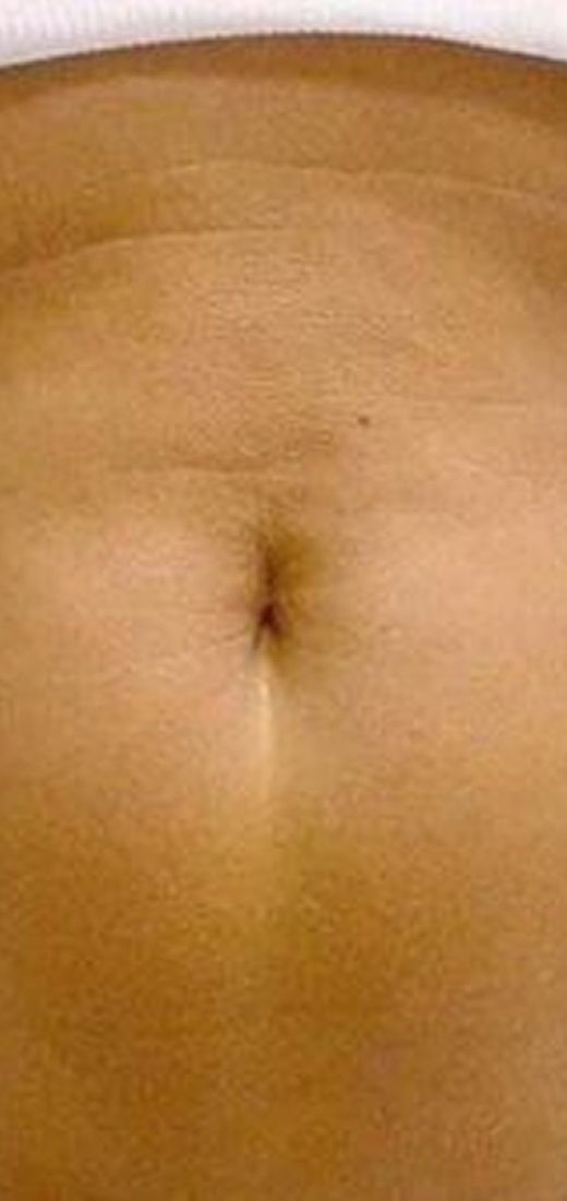 After image