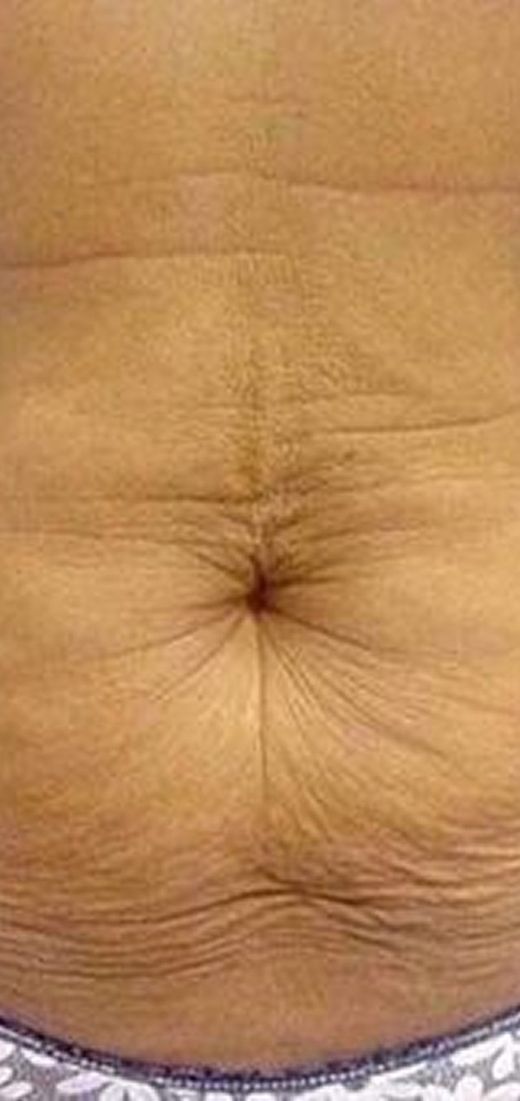 Before image